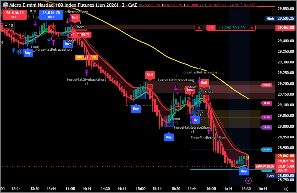 MNQ active chart monitoring screenshot from the trading workspace